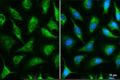 Immunocytochemistry/ Immunofluorescence: IDH3A Antibody [NBP1-32396]