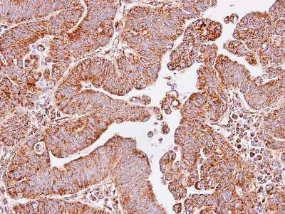 Immunohistochemistry-Paraffin: IDH3A Antibody [NBP1-32396]