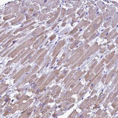 Immunohistochemistry-Paraffin: IDH3A Antibody [NBP1-85840]