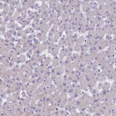 Immunohistochemistry-Paraffin: IDH3A Antibody [NBP1-85840]