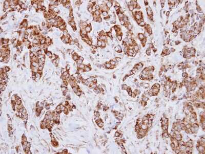 Immunohistochemistry-Paraffin: IDH3A Antibody [NBP2-16916]
