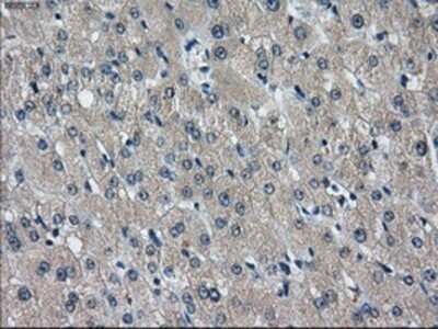Immunohistochemistry: IDH3A Antibody (OTI2F11) - Azide and BSA Free [NBP2-70992]