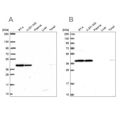 Western Blot: IDH3A Antibody [NBP2-57139]