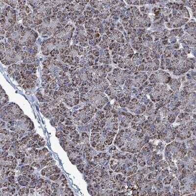 Immunohistochemistry-Paraffin: IDH3B Antibody [NBP2-14114]