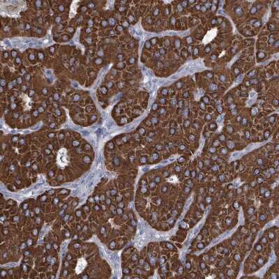 Immunohistochemistry-Paraffin: IDH3B Antibody [NBP2-14114]