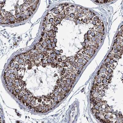 Immunohistochemistry-Paraffin: IDH3B Antibody [NBP2-14114]