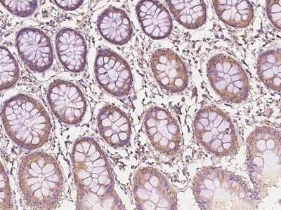 Immunohistochemistry-Paraffin: IDH3B Antibody [NBP2-97467]