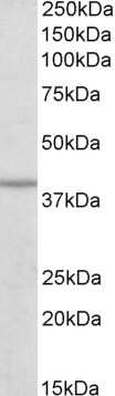 Western Blot: IDH3B Antibody [NBP1-78787]
