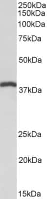 Western Blot: IDH3B Antibody [NBP1-78787]