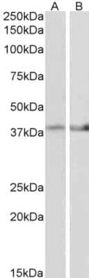 Western Blot: IDH3B Antibody [NBP1-78787]