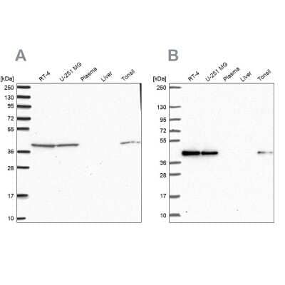 Western Blot: IDH3B Antibody [NBP2-14114]