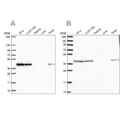 Western Blot: IDH3B Antibody [NBP2-58706]