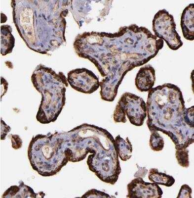 Immunohistochemistry-Paraffin: IDH3G Antibody [NBP1-85810]