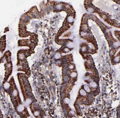 Immunohistochemistry-Paraffin: IDH3G Antibody [NBP1-85810]