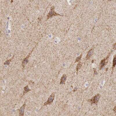 Immunohistochemistry-Paraffin: IDH3G Antibody [NBP1-85824]