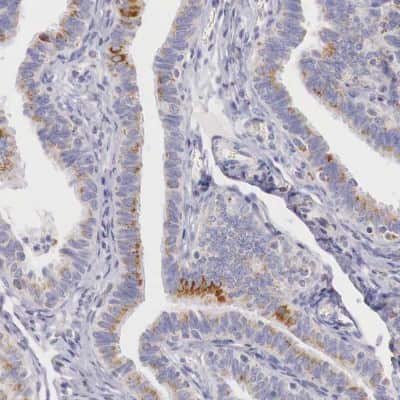 Immunohistochemistry-Paraffin: IDH3G Antibody [NBP1-85824]