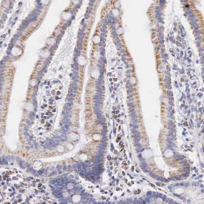 Immunohistochemistry-Paraffin: IDH3G Antibody [NBP1-85824]