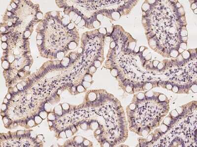 Immunohistochemistry-Paraffin: IDH3G Antibody [NBP2-97338]