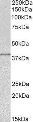Western Blot: IDH3G Antibody [NBP1-78786]