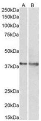 Western Blot: IDH3G Antibody [NBP1-78786]