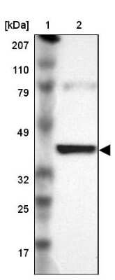 Western Blot: IDH3G Antibody [NBP1-85810]