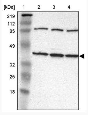 Western Blot: IDH3G Antibody [NBP1-85824]