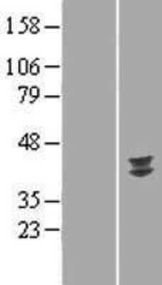 Western Blot: IDH3G Overexpression Lysate [NBP2-05069]