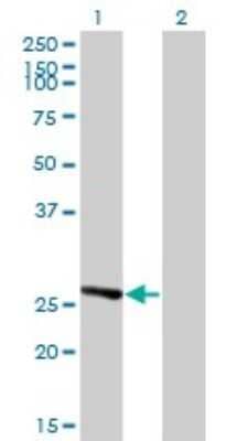 Western Blot: IDI1 Antibody (6G10) [H00003422-M01]