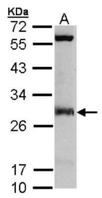 Western Blot: IDI1 Antibody [NBP1-31477]