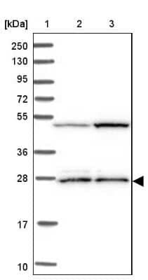 Western Blot: IDI1 Antibody [NBP1-85862]