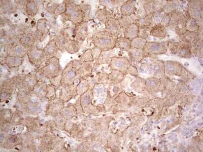 Immunohistochemistry: IDO2 Antibody (OTI11B2) [NBP2-46021]