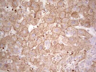 Immunohistochemistry: IDO2 Antibody (OTI11B2) - Azide and BSA Free [NBP2-72454]