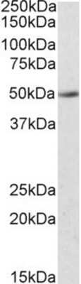 Western Blot: IDO2 Antibody [NBP1-45209]