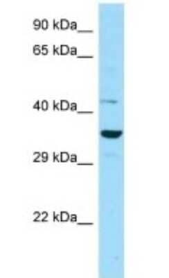 Western Blot: IDO2 Antibody [NBP1-98545]