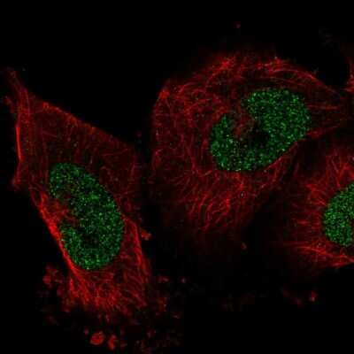 Immunocytochemistry/ Immunofluorescence: IER2 Antibody [NBP2-56018]