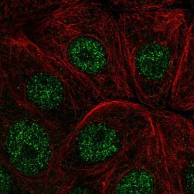 Immunocytochemistry/ Immunofluorescence: IER2 Antibody [NBP2-56845]