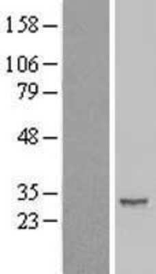 Western Blot: IER2 Overexpression Lysate [NBL1-11824]