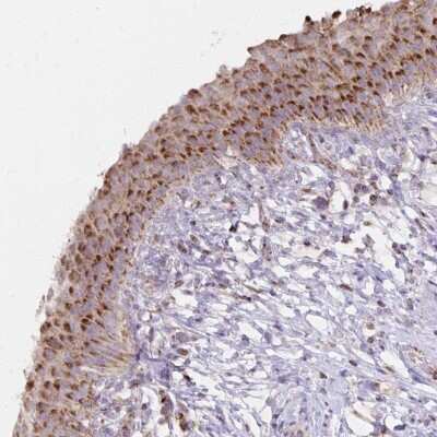 Immunohistochemistry-Paraffin: IER3 Antibody [NBP2-38513]