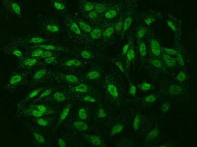 Immunocytochemistry/ Immunofluorescence: IER5 Antibody [NBP2-97507]