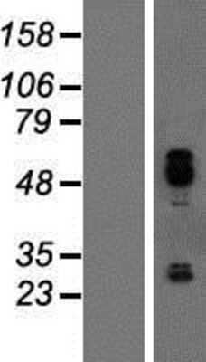 Western Blot: IER5 Overexpression Lysate [NBP2-07022]