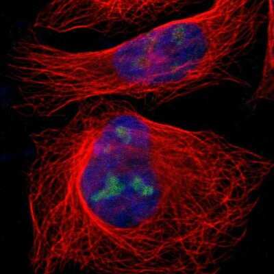 Immunocytochemistry/ Immunofluorescence: IF3EI Antibody [NBP1-87955]