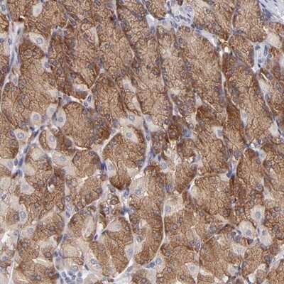 Immunohistochemistry-Paraffin: IF3EI Antibody [NBP1-87955]