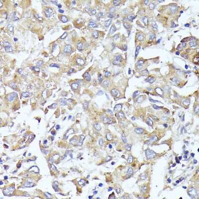 Immunohistochemistry-Paraffin: IF3EI Antibody - BSA Free [NBP3-03375]