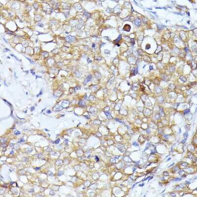 Immunohistochemistry-Paraffin: IF3EI Antibody - BSA Free [NBP3-03375]