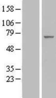 Western Blot: IF3EI Overexpression Lysate [NBL1-10193]