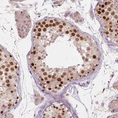 Immunohistochemistry: IFFO Antibody [NBP2-49598]