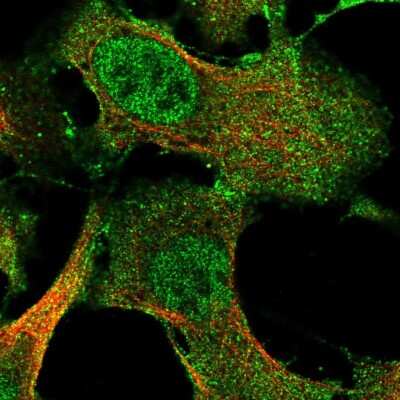 Immunocytochemistry/ Immunofluorescence: IFFO2 Antibody [NBP2-57033]