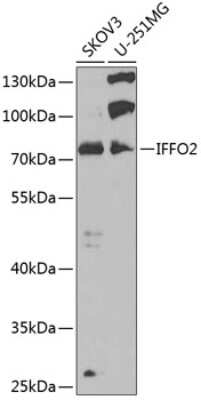 Western Blot: IFFO2 AntibodyBSA Free [NBP3-05222]