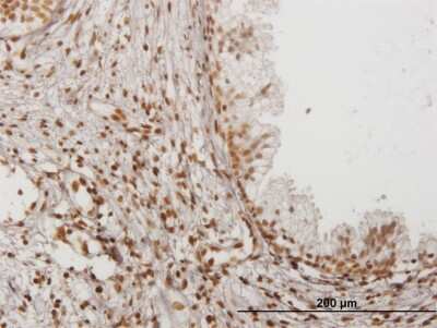 Immunohistochemistry-Paraffin: IFI16 Antibody (1B4) [H00003428-M05]