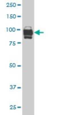 Western Blot: IFI16 Antibody (1B4) [H00003428-M05]